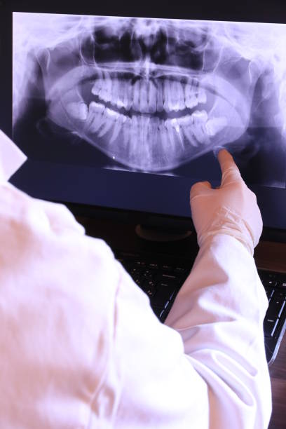 Best Emergency Tooth Extraction in Monroe, IA